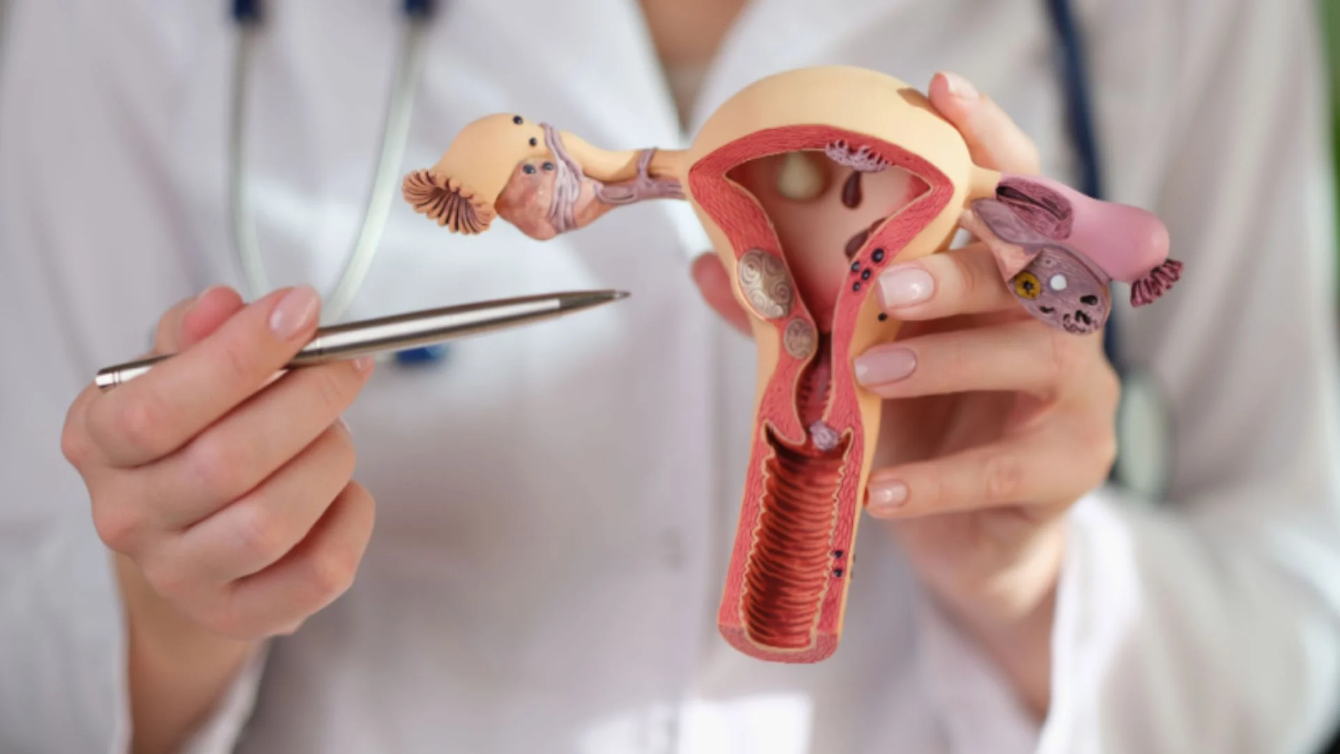 What Is Vaginismus? Causes, Symptoms, and Treatment